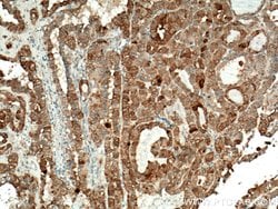 Galectin-3 Mouse anti-Human, Mouse, Rat, Clone: 1C1B2, Proteintech 150 &mu;L | Buy Online | Proteintech Group Inc | Fisher Scientific