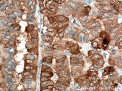 Galectin-3 Mouse anti-Human, Mouse, Rat, Clone: 1C1B2, Proteintech 150 &mu;L | Buy Online | Proteintech Group Inc | Fisher Scientific