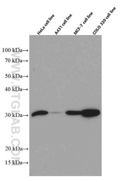 Galectin-3 Mouse anti-Human, Mouse, Rat, Clone: 1C1B2, Proteintech 150 &mu;L | Buy Online | Proteintech Group Inc | Fisher Scientific