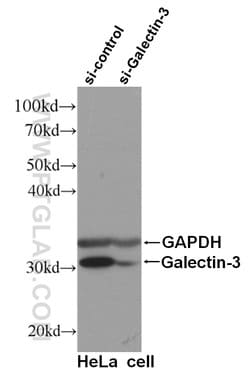 Galectin-3 Mouse anti-Human, Mouse, Rat, Clone: 1C1B2, Proteintech 150 &mu;L | Buy Online | Proteintech Group Inc | Fisher Scientific