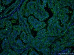 Galectin-3 Mouse anti-Human, Mouse, Rat, Clone: 1C1B2, Proteintech 150 &mu;L | Buy Online | Proteintech Group Inc | Fisher Scientific