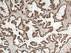 Galectin-3 Mouse anti-Human, Mouse, Rat, Clone: 1C1B2, Proteintech 150 &mu;L | Buy Online | Proteintech Group Inc | Fisher Scientific