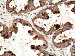 Galectin-3 Mouse anti-Human, Mouse, Rat, Clone: 1C1B2, Proteintech 150 &mu;L | Buy Online | Proteintech Group Inc | Fisher Scientific