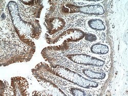 Galectin-3 Mouse anti-Human, Mouse, Rat, Clone: 1C1B2, Proteintech 150 &mu;L | Buy Online | Proteintech Group Inc | Fisher Scientific