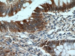 Galectin-3 Mouse anti-Human, Mouse, Rat, Clone: 1C1B2, Proteintech 150 &mu;L | Buy Online | Proteintech Group Inc | Fisher Scientific
