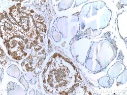 Galectin-3 Mouse anti-Human, Mouse, Rat, Clone: 1C1B2, Proteintech 150 &mu;L | Buy Online | Proteintech Group Inc | Fisher Scientific