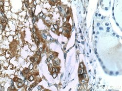 Galectin-3 Mouse anti-Human, Mouse, Rat, Clone: 1C1B2, Proteintech 150 &mu;L | Buy Online | Proteintech Group Inc | Fisher Scientific
