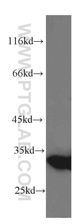 Galectin-3 Mouse anti-Human, Mouse, Rat, Clone: 1C1B2, Proteintech 150 &mu;L | Buy Online | Proteintech Group Inc | Fisher Scientific