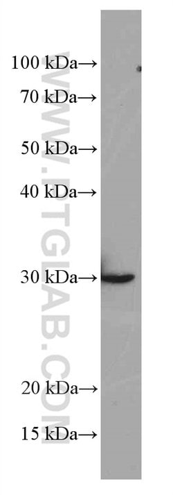 Galectin-3 Mouse anti-Human, Mouse, Rat, Clone: 1C1B2, Proteintech 150 &mu;L | Buy Online | Proteintech Group Inc | Fisher Scientific