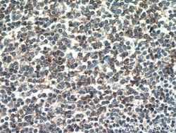 CD23 Mouse anti-Human, Mouse, Clone: 4C7C9, Proteintech:Antibodies:Primary