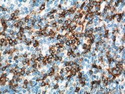 CD7 Mouse anti-Human, Mouse, Clone: 1G10D8, Proteintech:Antibodies:Primary