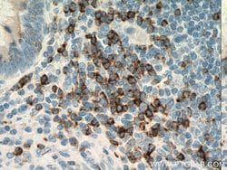 CD7 Mouse anti-Human, Mouse, Clone: 1G10D8, Proteintech:Antibodies:Primary