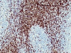 CD7 Mouse anti-Human, Mouse, Clone: 1G10D8, Proteintech:Antibodies:Primary