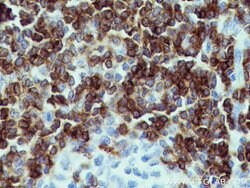 CD7 Mouse anti-Human, Mouse, Clone: 1G10D8, Proteintech:Antibodies:Primary