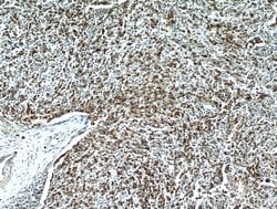 CD7 Mouse anti-Human, Mouse, Clone: 1G10D8, Proteintech:Antibodies:Primary