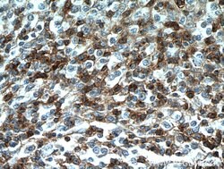 CD7 Mouse anti-Human, Mouse, Clone: 1G10D8, Proteintech:Antibodies:Primary