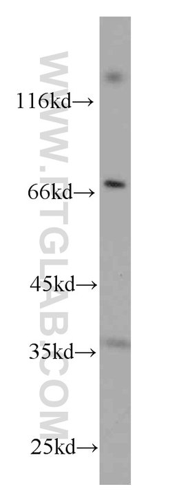 CD7 Mouse anti-Human, Mouse, Clone: 1G10D8, Proteintech:Antibodies:Primary