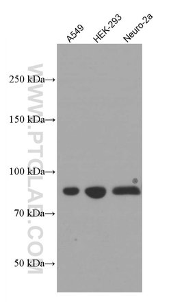 PI3K p85 alpha Mouse anti-Human, Mouse, Porcine, Rat, Clone: 4G3C11, Proteintech