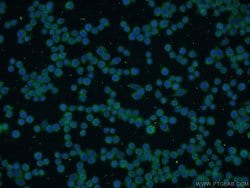 PI3K p85 alpha Mouse anti-Human, Mouse, Porcine, Rat, Clone: 4G3C11, Proteintech