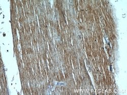 PI3K p85 alpha Mouse anti-Human, Mouse, Porcine, Rat, Clone: 4G3C11, Proteintech