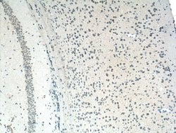PI3K p85 alpha Mouse anti-Human, Mouse, Porcine, Rat, Clone: 4G3C11, Proteintech