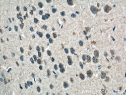 PI3K p85 alpha Mouse anti-Human, Mouse, Porcine, Rat, Clone: 4G3C11, Proteintech