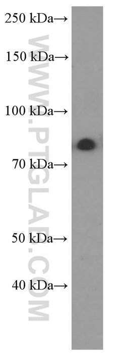 PI3K p85 alpha Mouse anti-Human, Mouse, Porcine, Rat, Clone: 4G3C11, Proteintech
