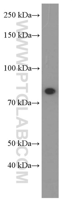 PI3K p85 alpha Mouse anti-Human, Mouse, Porcine, Rat, Clone: 4G3C11, Proteintech