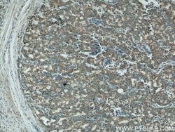 COXIV Mouse anti-Human, Mouse, Clone: 3C7D2, Proteintech:Anticuerpos:Anticuerpos