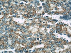 COXIV Mouse anti-Human, Mouse, Clone: 3C7D2, Proteintech:Anticuerpos:Anticuerpos