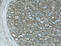 COXIV Mouse anti-Human, Mouse, Clone: 3C7D2, Proteintech:Anticuerpos:Anticuerpos