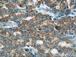COXIV Mouse anti-Human, Mouse, Clone: 3C7D2, Proteintech:Anticuerpos:Anticuerpos