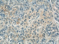 COXIV Mouse anti-Human, Mouse, Clone: 3C7D2, Proteintech:Anticuerpos:Anticuerpos