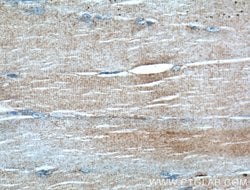 IGBP1 Mouse anti-Human, Mouse, Clone: 2D11A8, Proteintech 150 &mu;L; Unconjugated:Antibodies,