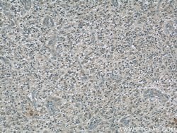 Dynamitin (1-401 AA) Mouse anti-Human, Mouse, Clone: 2B9A5, Proteintech 150 &mu;L | Buy Online | Proteintech | Fisher Scientific