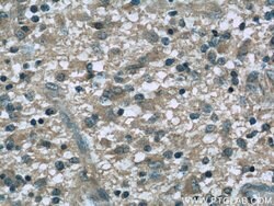 Dynamitin (1-401 AA) Mouse anti-Human, Mouse, Clone: 2B9A5, Proteintech 150 &mu;L | Buy Online | Proteintech | Fisher Scientific