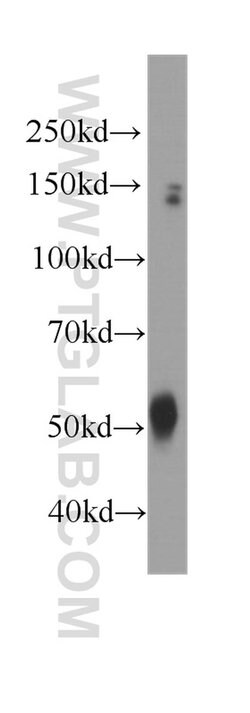 Dynamitin (1-401 AA) Mouse anti-Human, Mouse, Clone: 2B9A5, Proteintech 150 &mu;L | Buy Online | Proteintech | Fisher Scientific