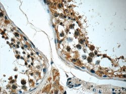 CCT3 Mouse anti-Human, Mouse, Clone: 5F5A6, Proteintech 150 &mu;L; Unconjugated:Antibodies,