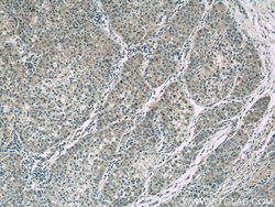 CCT3 Mouse anti-Human, Mouse, Clone: 5F5A6, Proteintech 150 &mu;L; Unconjugated:Antibodies,