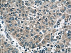 CCT3 Mouse anti-Human, Mouse, Clone: 5F5A6, Proteintech 150 &mu;L; Unconjugated:Antibodies,