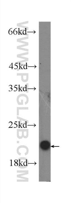 IL-10 Mouse anti-Human, Clone: 8E4B6, Proteintech 150 &mu;L; Unconjugated:Antibodies,