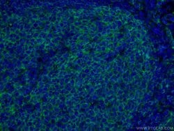 CD20 Mouse anti-Human, Clone: 4A7G3, Proteintech:Antibodies:Primary Antibodies