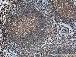 CD20 Mouse anti-Human, Clone: 4A7G3, Proteintech:Antibodies:Primary Antibodies