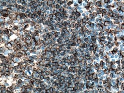 CD20 Mouse anti-Human, Clone: 4A7G3, Proteintech:Antibodies:Primary Antibodies