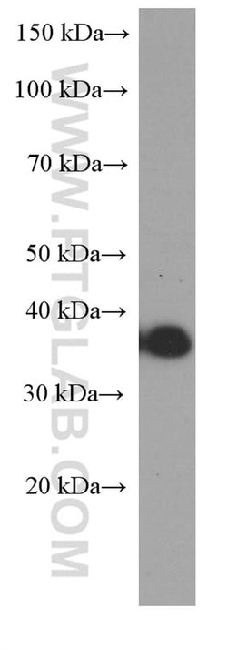 CD20 Mouse anti-Human, Clone: 4A7G3, Proteintech:Antibodies:Primary Antibodies