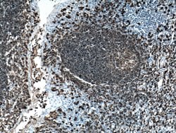 CD20 Mouse anti-Human, Clone: 4A7G3, Proteintech:Antibodies:Primary Antibodies