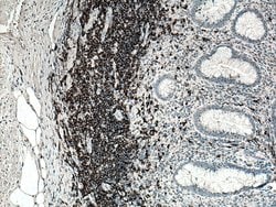 CD20 Mouse anti-Human, Clone: 4A7G3, Proteintech:Antibodies:Primary Antibodies