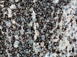 CD20 Mouse anti-Human, Clone: 4A7G3, Proteintech:Antibodies:Primary Antibodies