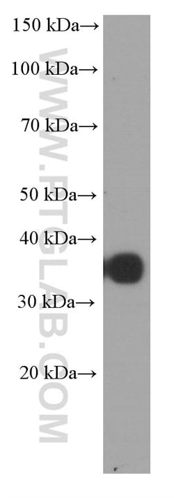 CD20 Mouse anti-Human, Clone: 4A7G3, Proteintech:Antibodies:Primary Antibodies