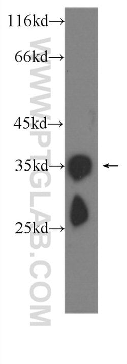 CRYBB1 Mouse anti-Human, Mouse, Rat, Clone: 6F12B12, Proteintech 150 &mu;L;